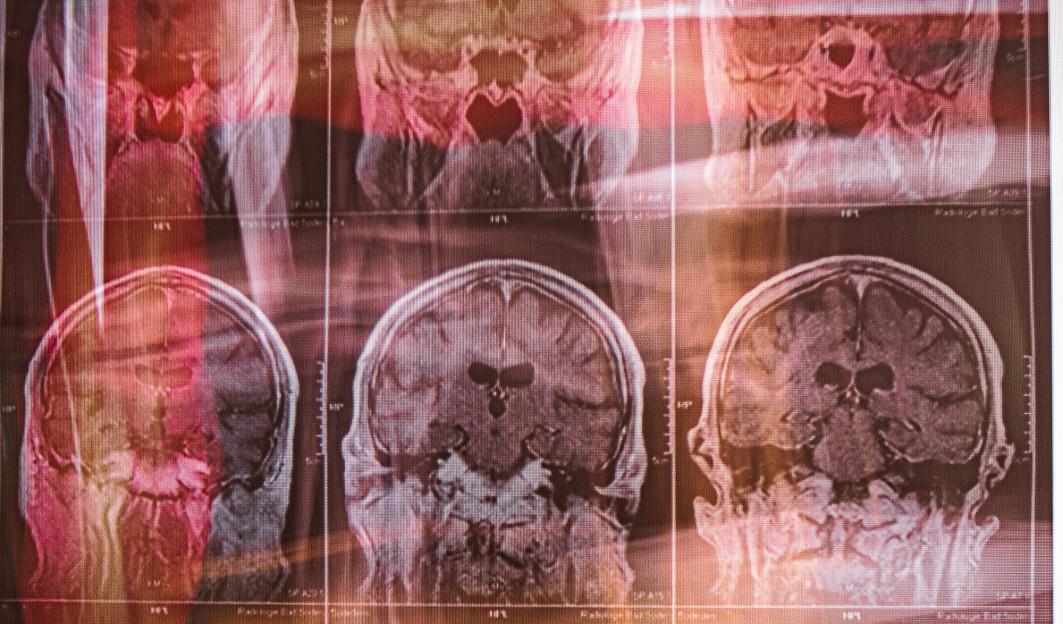 x-heike-spoehrer-010